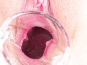 小穴图鉴有賀ゆあマンコ図鑑